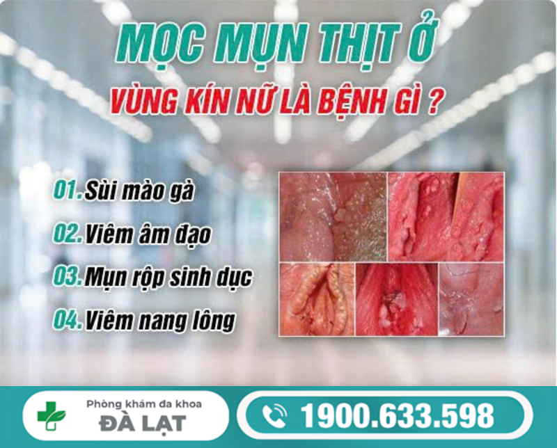 Hình ảnh minh họa